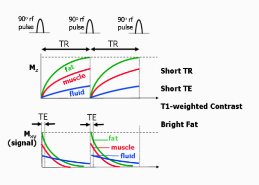 T1 T2