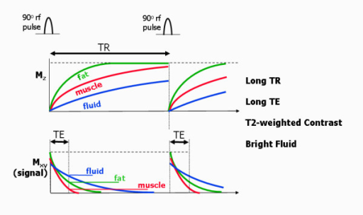 T2 weighted spin echo T1 and T2 relaxation curves for 