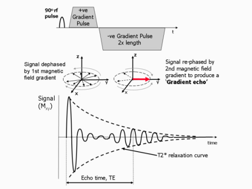 spin echo sequence diagram spin echo sequence diagram