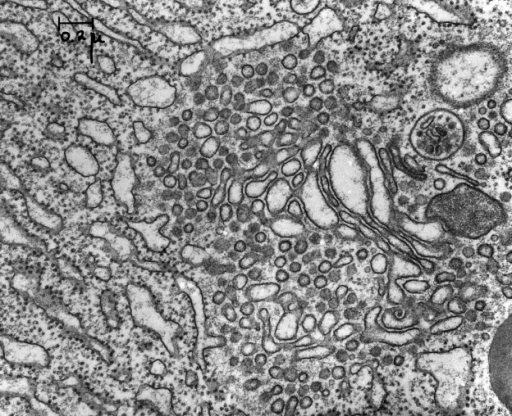 Electron micrograph taken by George Palade. Pancreatic | Open-i