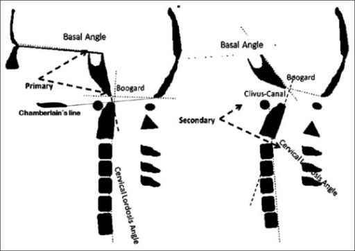 At Left Are Represented The Primary Angles Basal Angle Open I 1779