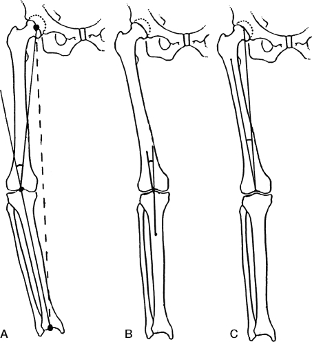 Schematic pictures showing the methods for radiographic | Open-i