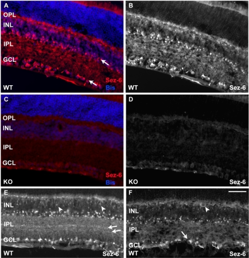 Immunostaining for Sez-6 in the mouse retina reveals la | Open-i