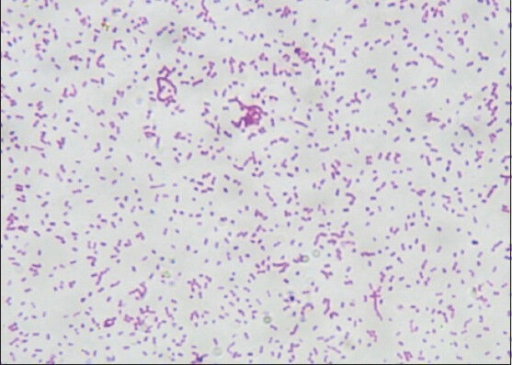 Pasteurella Multocida Gram Stain