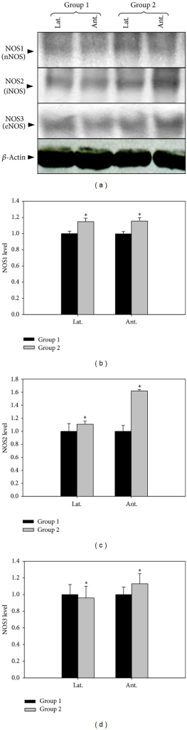 The Effect Of 5 Alpha Reductase Inhibitor On Expressions Of Nnos Inos And The Effect Of 5 Alpha Reductase Inhibitor On Expressions Of Nnos Inos And