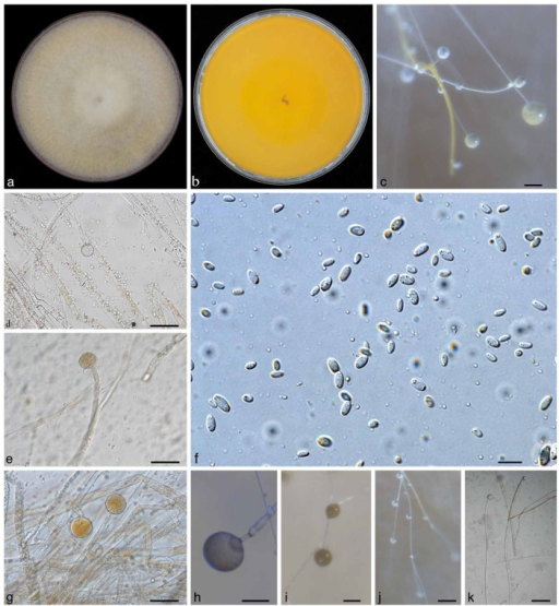 Macroscopic And Microscopic Morphology Of Mucor Irregul | Open-i