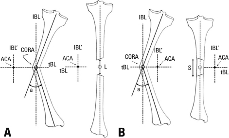 ACA-CORA Rule 1. If the ACA is located on the concave s | Open-i