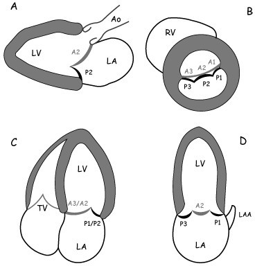 Standardized 2D-TTE imaging planes to assess the precis | Open-i