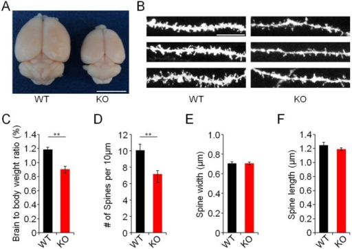 What limits brain size