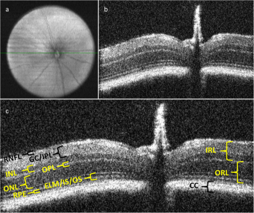 Optical Coherence Tomography: Imaging Mouse Retinal Ganglion Cells In Vivo