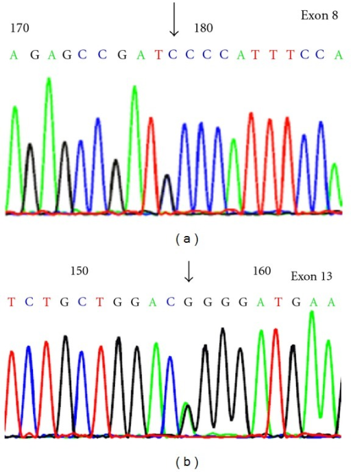 FAH gene sequencing study in heterozygous pregnancy (3r | Open-i