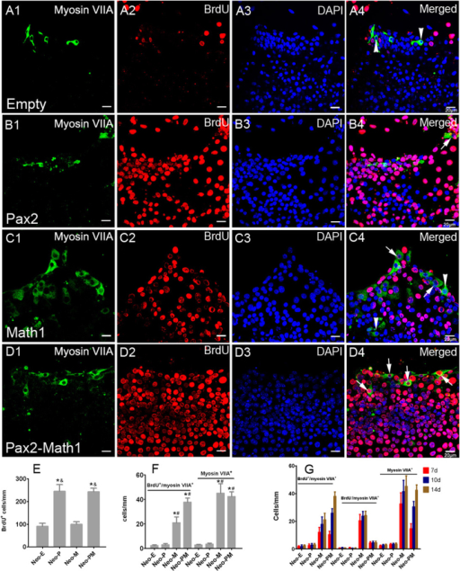 Forced Math1 expression promoted hair cell formation in | Open-i