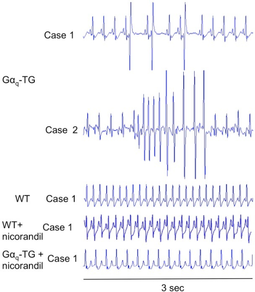 Ecg Lead Ii Recordings From Wt Wtnicorandil Gαq Tg Open I