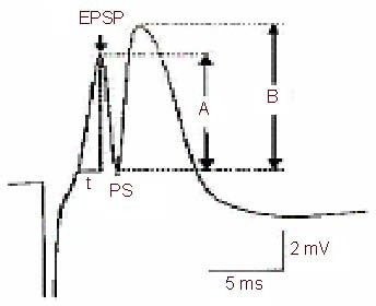 Population spike (PS) amplitude equals half of the addi | Open-i