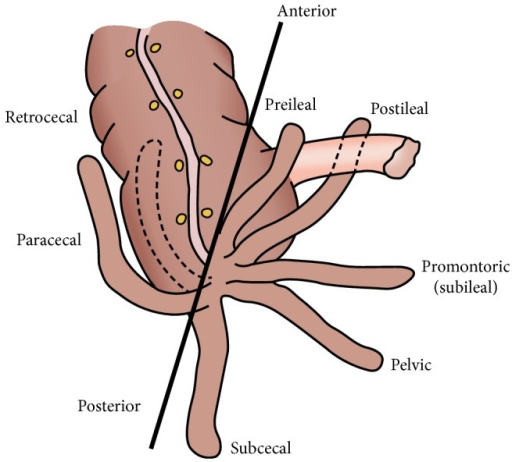 Image result for appendix positions