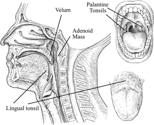 Illustrated are the components of Waldeyer’s ring of | Open-i