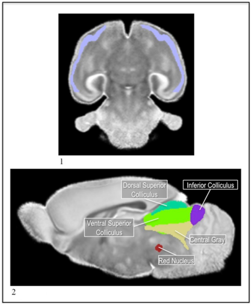 1) The P14 piriform in the MD.2) The P14 red nucleus (r | Open-i