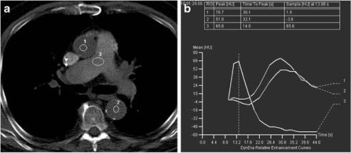 Test Bolus Technique For Identification Of Contrast Arrival In Target ...