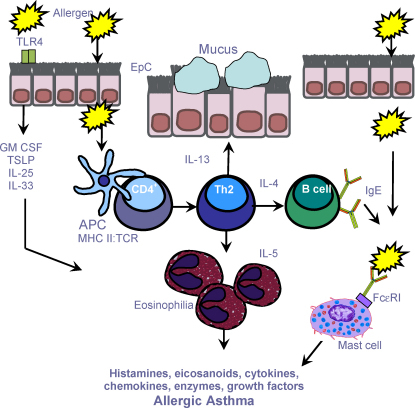 Immune cells and the inflammatory cascade in asthma. In | Open-i