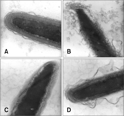 How clear traces of sperm How clear traces of sperm