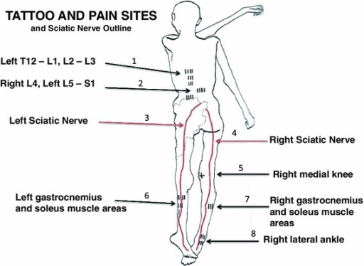 a graphic outline of the prone and supine positions of a graphic outline of the prone and supine positions of