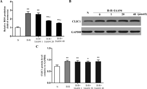 CLIC1 regulates the production of ROS in SGC-7901 gastr