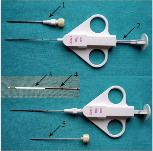 Coaxial Biopsy Technique Using Quick Core Biopsy Set. T 