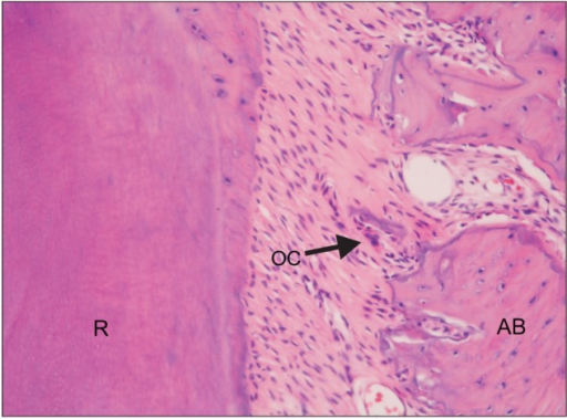 Histological examination of the compression areas of pe | Open-i