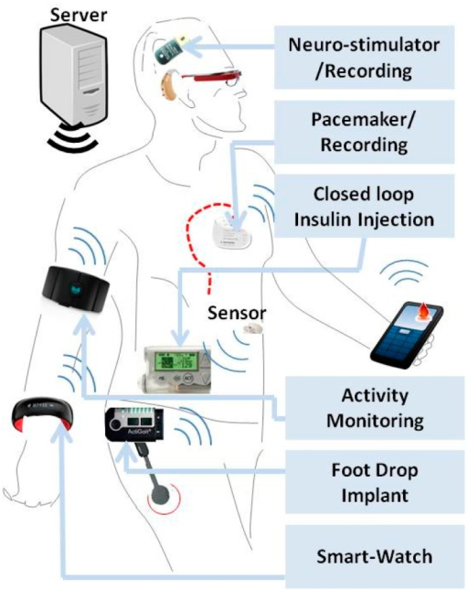 WBS technology for POC diagnostics of various diseases | Open-i