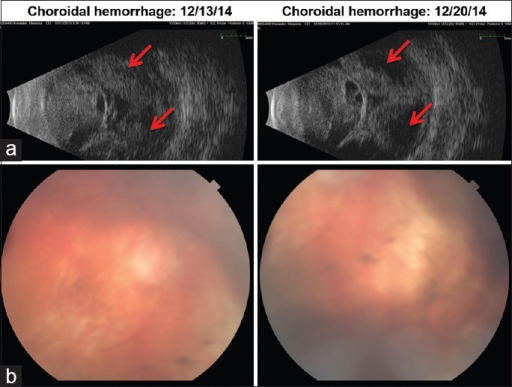 Timing Of Surgery A 75 Year Old Woman With Severe Sjogren Disease And Timing Of Surgery A 75 Year Old Woman With Severe Sjogren Disease And