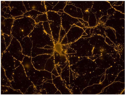 Primary Cortical Neurons Labeled With Beta Tubulin Iii Open I 0767