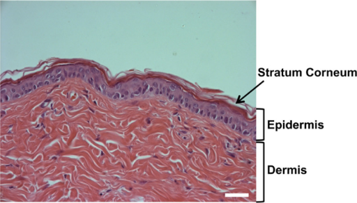 Structure of mammalian skin. Intact skin of mouse was s | Open-i