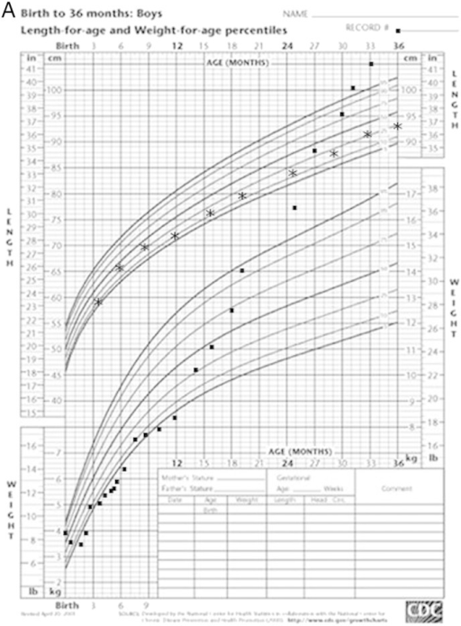 A. Growth chart of proband demonstrating marked failure | Open-i