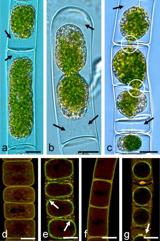 plasmolysis to study the permeability of plasma membranes biology essay How do the cells in your body define their boundaries (and control what comes in or goes out) as it turns out, cells have a sophisticated and flexible barrier, the plasma membrane, and a wide array of strategies for transporting molecules in and out. plasmolysis to study the permeability of plasma membranes biology essay How do the cells in your body define their boundaries (and control what comes in or goes out) as it turns out, cells have a sophisticated and flexible barrier, the plasma membrane, and a wide array of strategies for transporting molecules in and out.