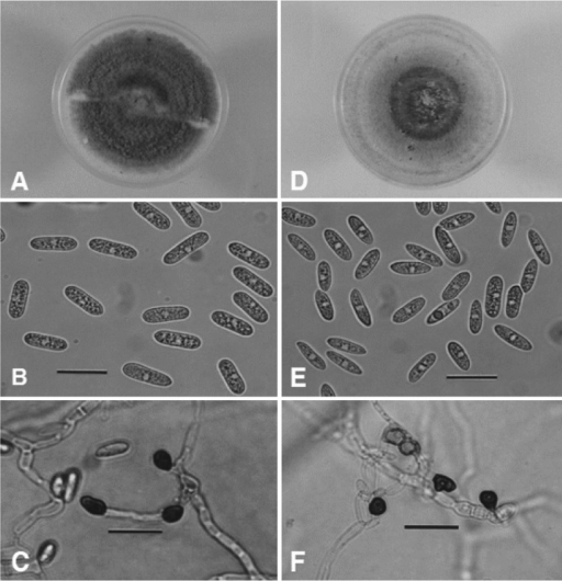 Morphological Features Of Colletotrichum Gloeosporioide | Open-i