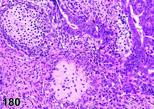 malignant-mixed-mullerian-tumor-mmmt-uterus-rat-open-i