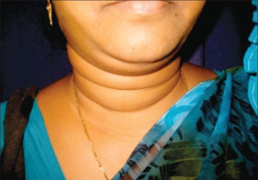 remnant-of-skin-folds-on-the-neck-open-i