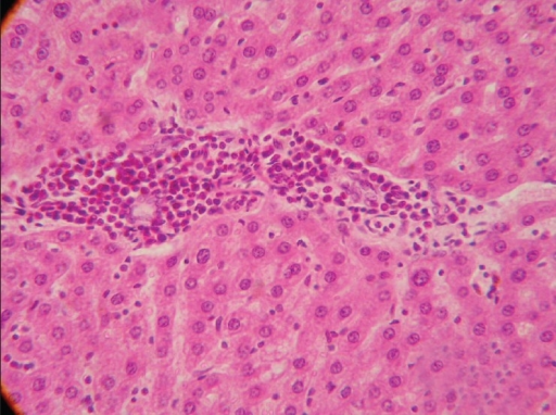 Section of liver (Group G2) showing infiltration of inf | Open-i