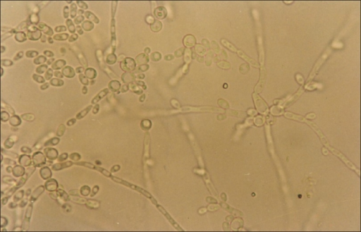 Photomicrograph showing large, terminal, thick-walled c | Open-i