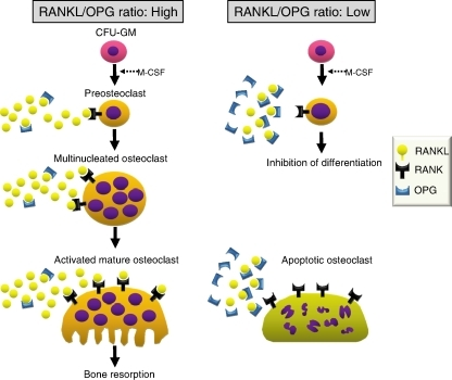 RANKL mediated osteoclastogenesis. Osteoclast precursor | Open-i