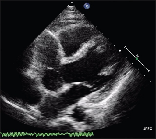 Two-dimensional (2D) echocardiography in modified five | Open-i