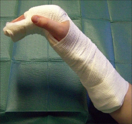 Plaster secured to arm with bandage and tape | Open-i