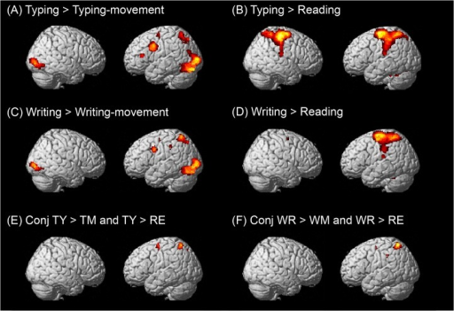 Essay about the brain