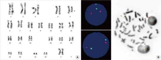 Karyotype And FISH Analyses. (A) Chromosomal Analysis S | Open-i