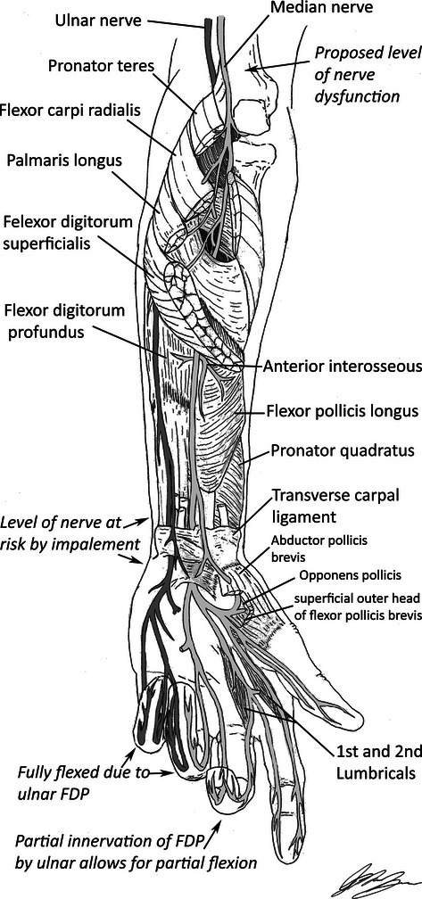 Ulnar nerve anatomy in the hand.